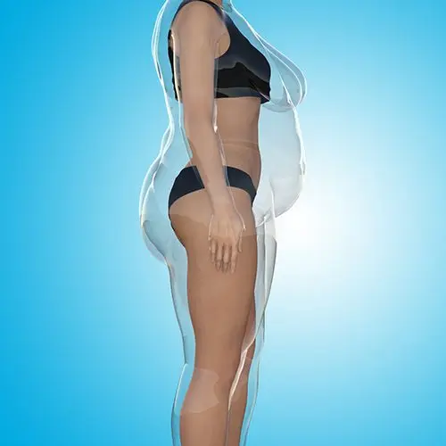Conceptual image of a fat and skinny women